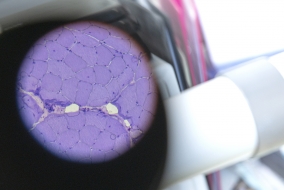 Voilà à quoi ressemble la découpe d'un muscle au microscope…