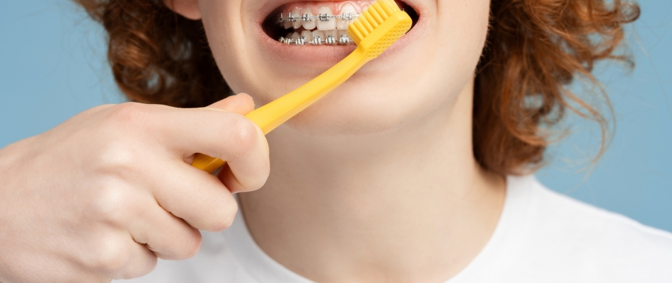 L'appareil dentaire, toujours une contrainte pour les ados - Minizap Pays Voironnais