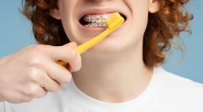 L'appareil dentaire, toujours une contrainte pour les ados