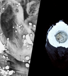 Exposition : "Anatomie du silence"