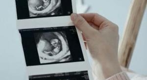 Grossesses miraculeuses : le combat d'une vie - Ép...